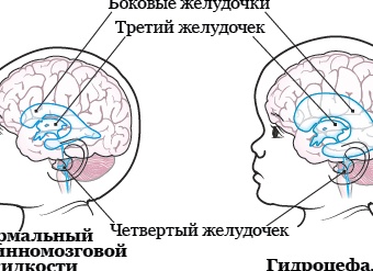Почему ребёнок теряет баллы в сочинении ЕГЭ (даже если знает структуру)