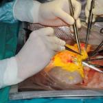 Transplant de organe și țesuturi