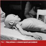Boli din timpul asediului Leningradului
